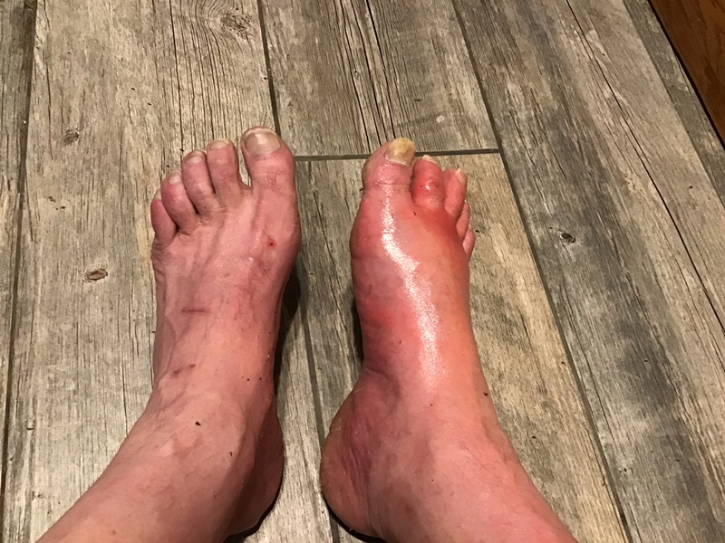 Infection out of control